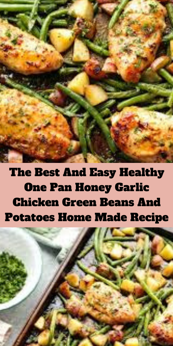 The Best And Easy Healthy One Pan Honey Garlic Chicken Green Beans And Potatoes Home Made Recipe
